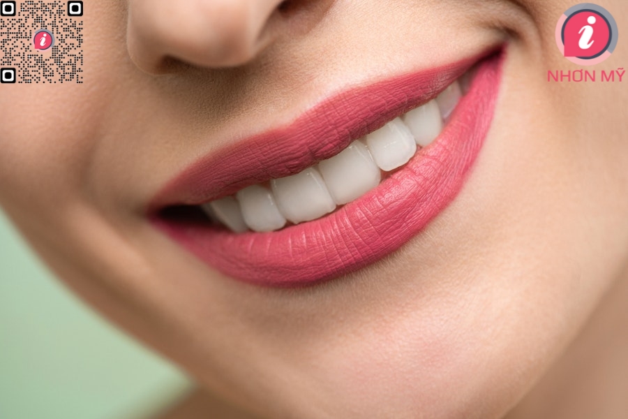 Hình ảnh về dịch vụ tẩy trắng răng của nha khoa