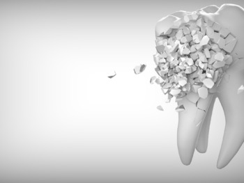 Đây là dòng răng toàn sứ, được cấu tạo hoàn toàn từ sứ